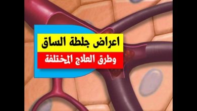 6 أعراض تدل على وجود جلطات بجسمك